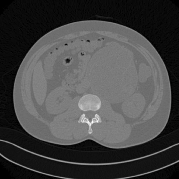 graphic file with name 464_2023_10072_Figfg_HTML.jpg