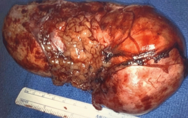 graphic file with name 464_2023_10072_Figgq_HTML.jpg