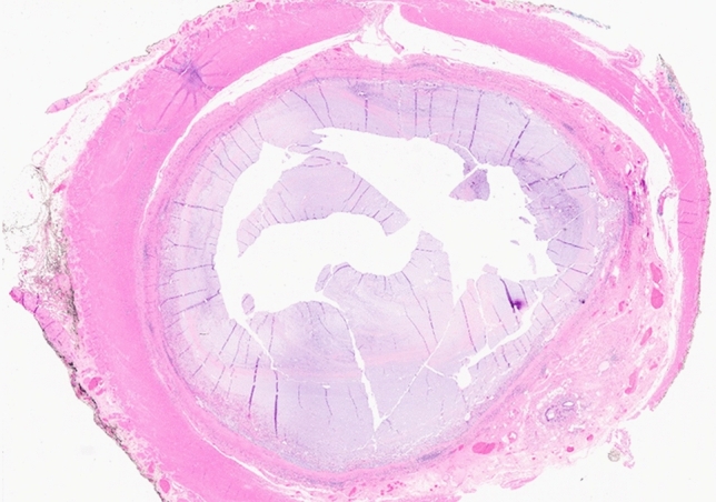 graphic file with name 464_2023_10072_Figfo_HTML.jpg