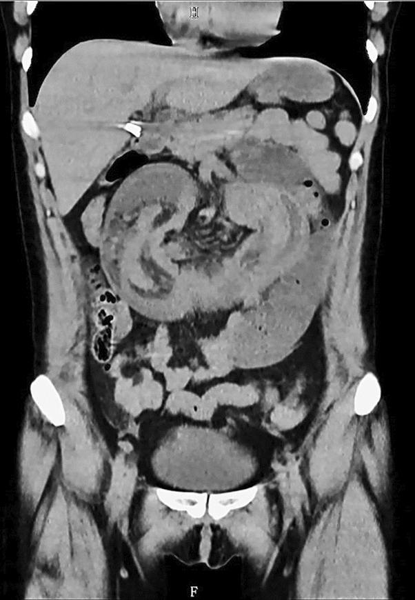 graphic file with name 464_2023_10072_Figm_HTML.jpg