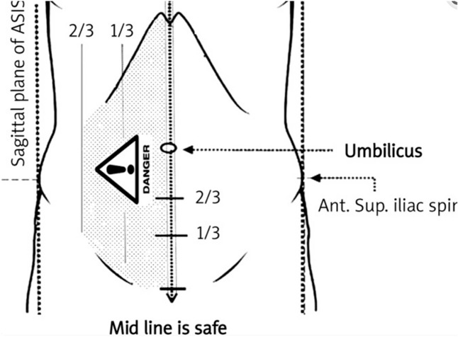 graphic file with name 464_2023_10072_Figf_HTML.jpg