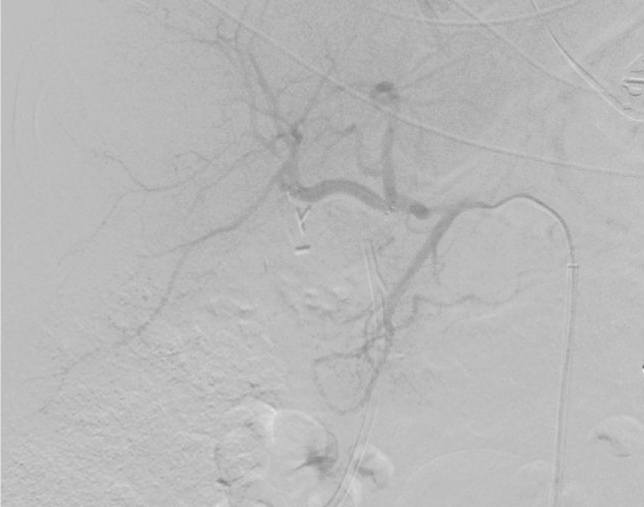 graphic file with name 464_2023_10072_Figbh_HTML.jpg