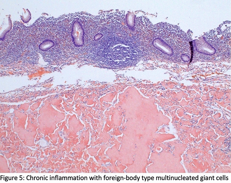 graphic file with name 464_2023_10072_Figcp_HTML.jpg