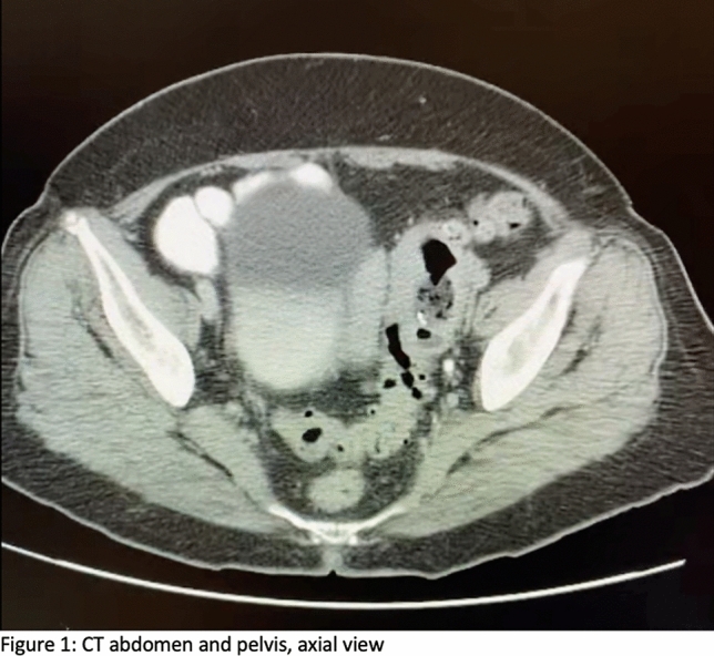 graphic file with name 464_2023_10072_Figcl_HTML.jpg