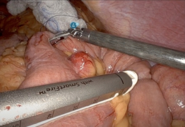 graphic file with name 464_2023_10072_Figaz_HTML.jpg