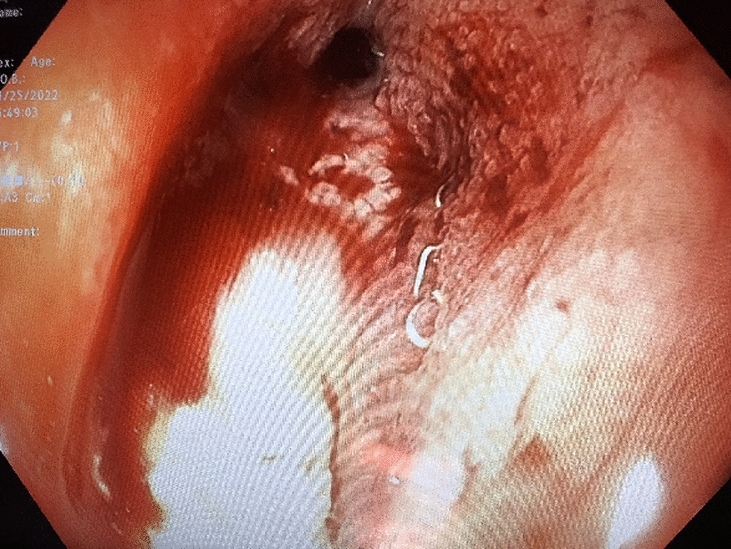 graphic file with name 464_2023_10072_Figeb_HTML.jpg