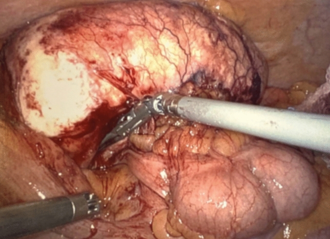 graphic file with name 464_2023_10072_Figgp_HTML.jpg