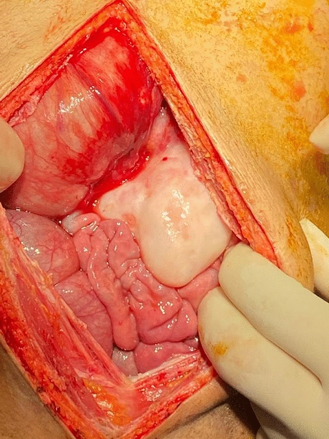 graphic file with name 464_2023_10072_Figce_HTML.jpg