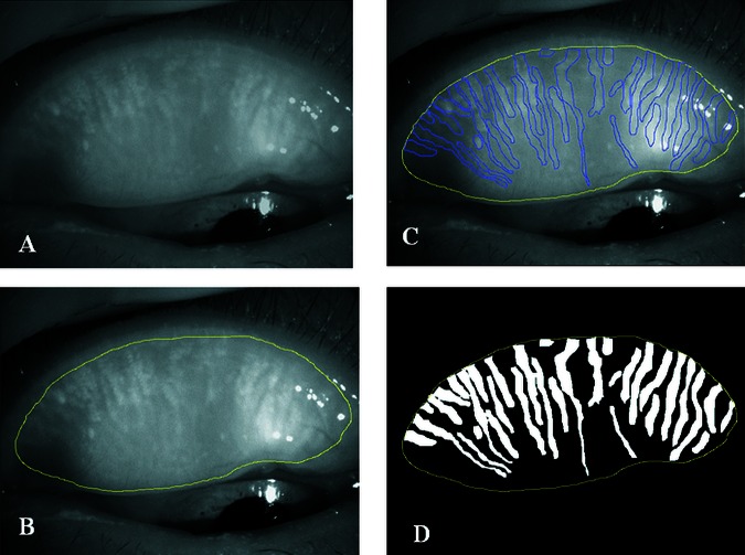 Figure 1