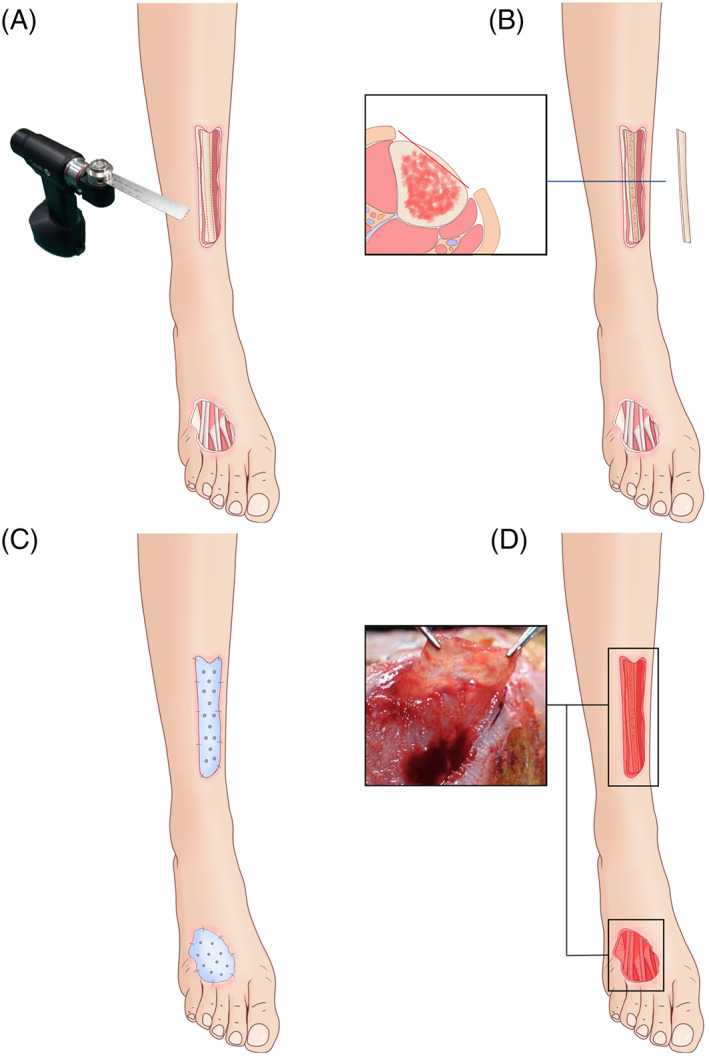 FIGURE 1