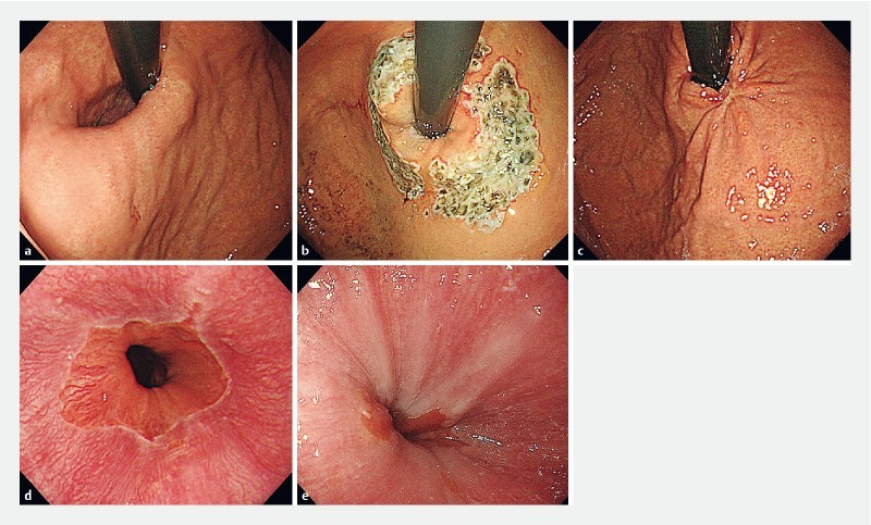 Fig. 2