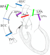 Illustration of sites of the through-plane flows used for complete
hemodynamics assessment of patients with Fontan circulation. In the absence
of regurgitant lesions, patent fenestration, or significant
systemic-to-collateral flow, aortic forward flow should be equal to total
systemic venous return (superior vena cava [SVC] + inferior vena cava [IVC]
flows) and also to total pulmonary venous return (right pulmonary veins
[RPVs] + left pulmonary veins [LPVs] flows). Discrepancy in flows should
indicate the presence of any of the aforementioned lesions, whereas
segmental analysis of flows in the circuit may allow quantification of their
entity at each level. Ao = aorta, ECC = extracardiac conduit, LPA = left
pulmonary artery, RPA = right pulmonary artery.