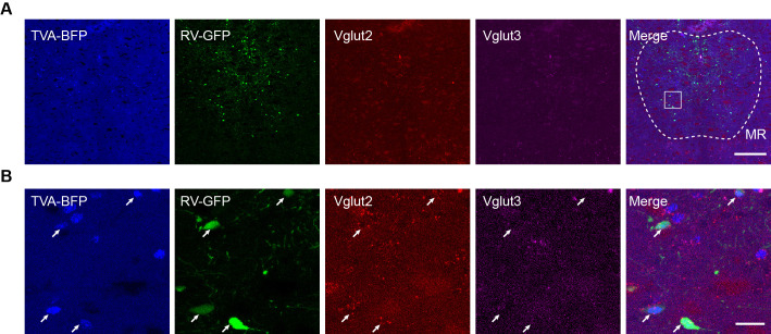 Figure 1—figure supplement 3.