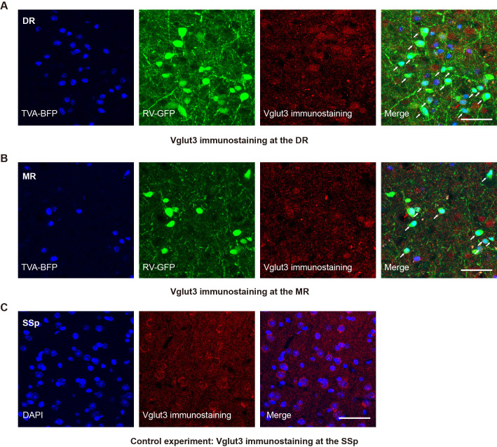 Figure 1—figure supplement 4.