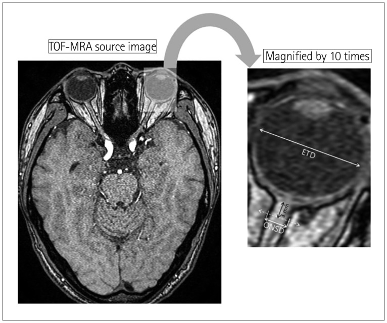 Fig. 2