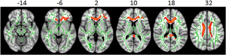 Fig 3