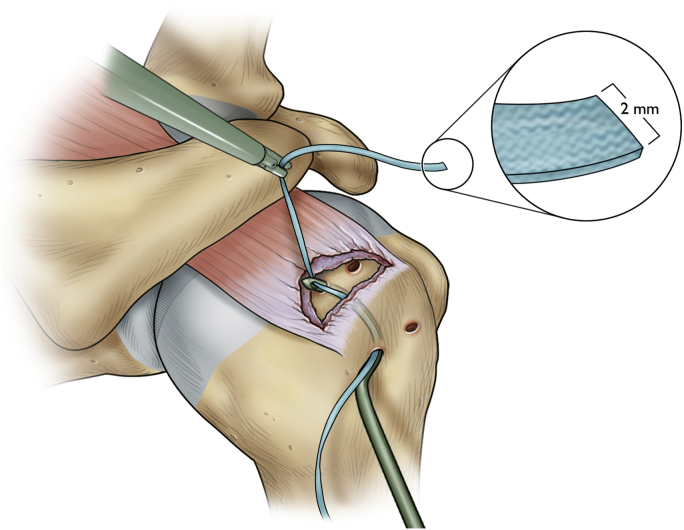 Figure 2