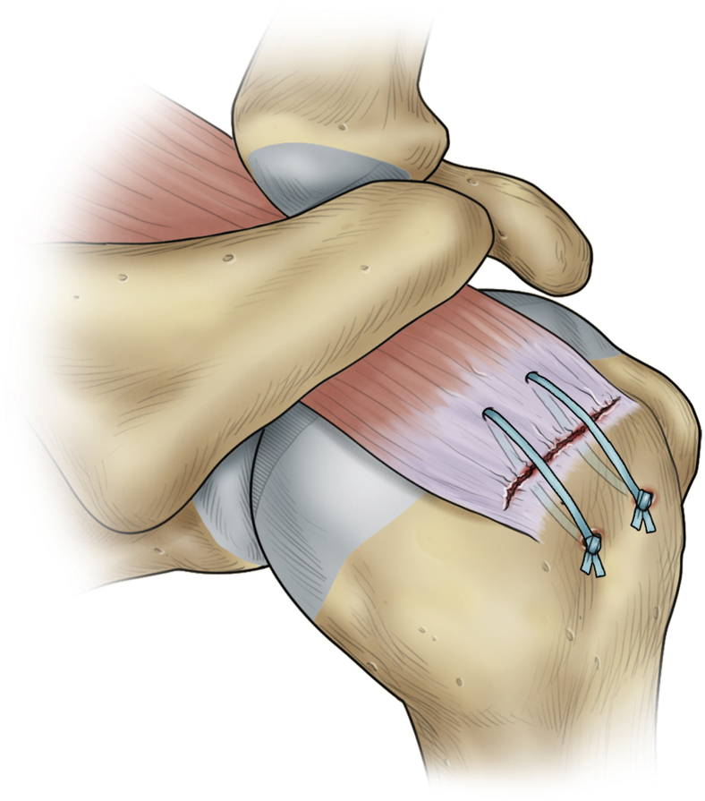 Figure 4