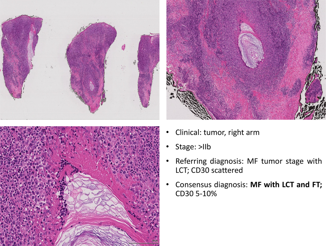 Figure 5: