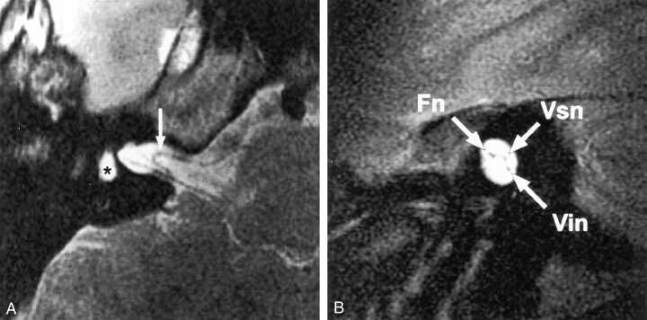 Fig 5.