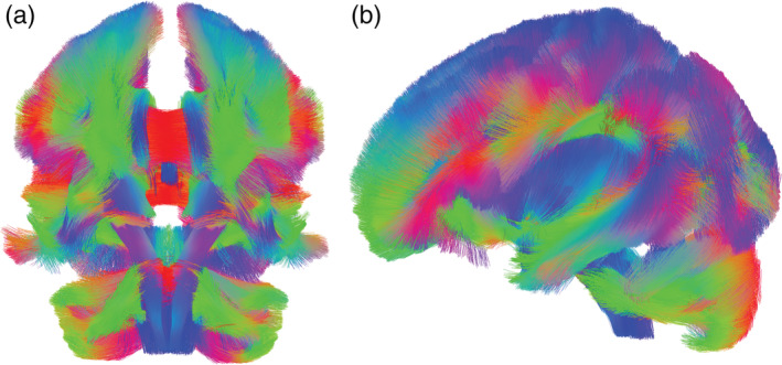 FIGURE 1