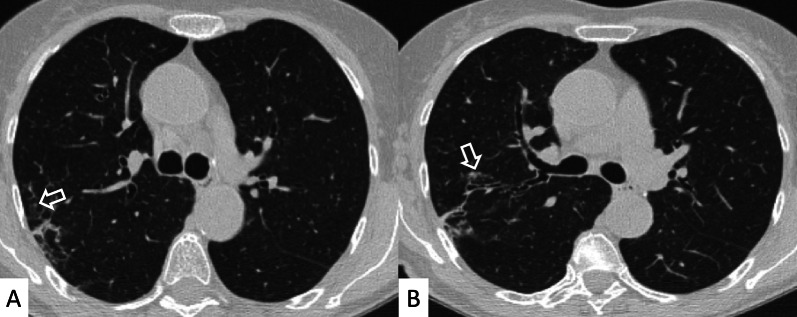 Fig. 24