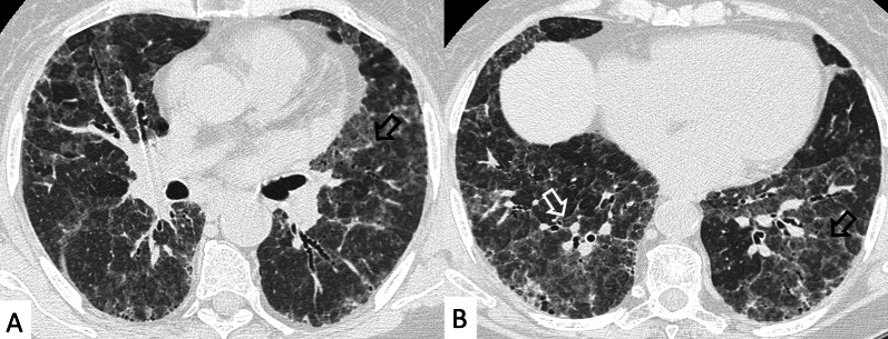 Fig. 29