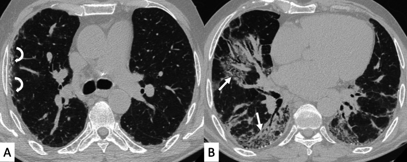 Fig. 15