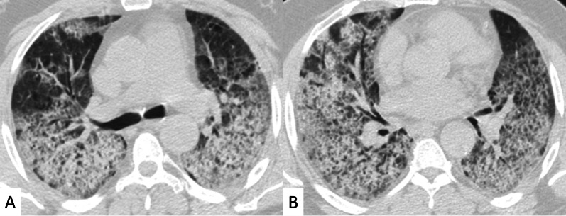 Fig. 22