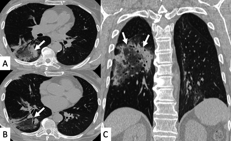 Fig. 19