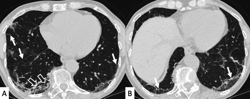 Fig. 18