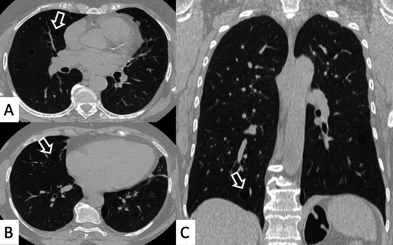 Fig. 26