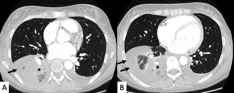 Fig. 21