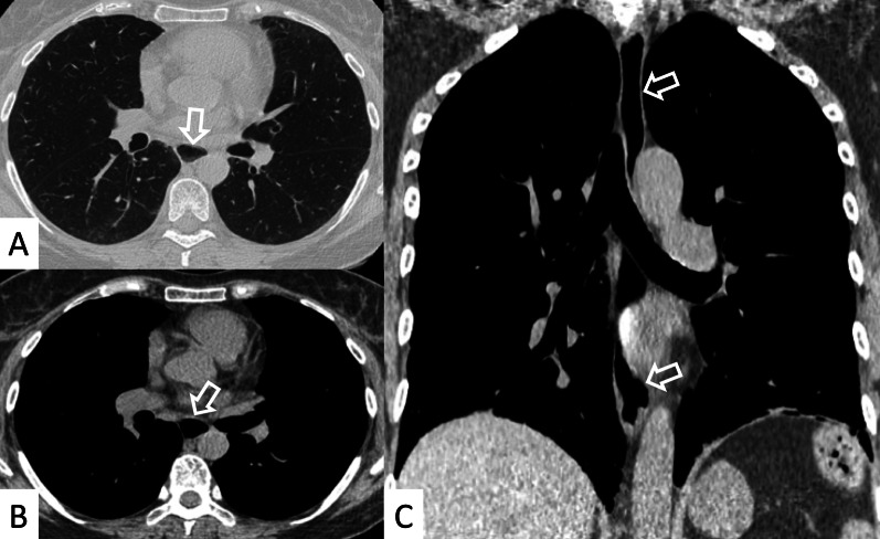 Fig. 14