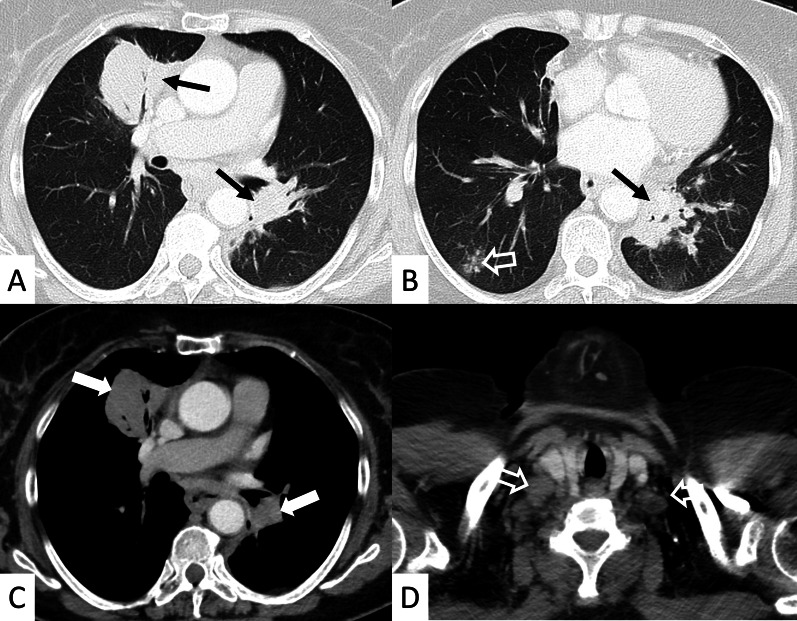 Fig. 28