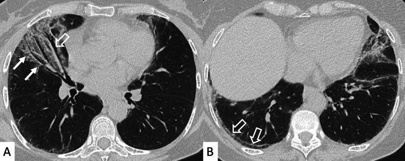 Fig. 16