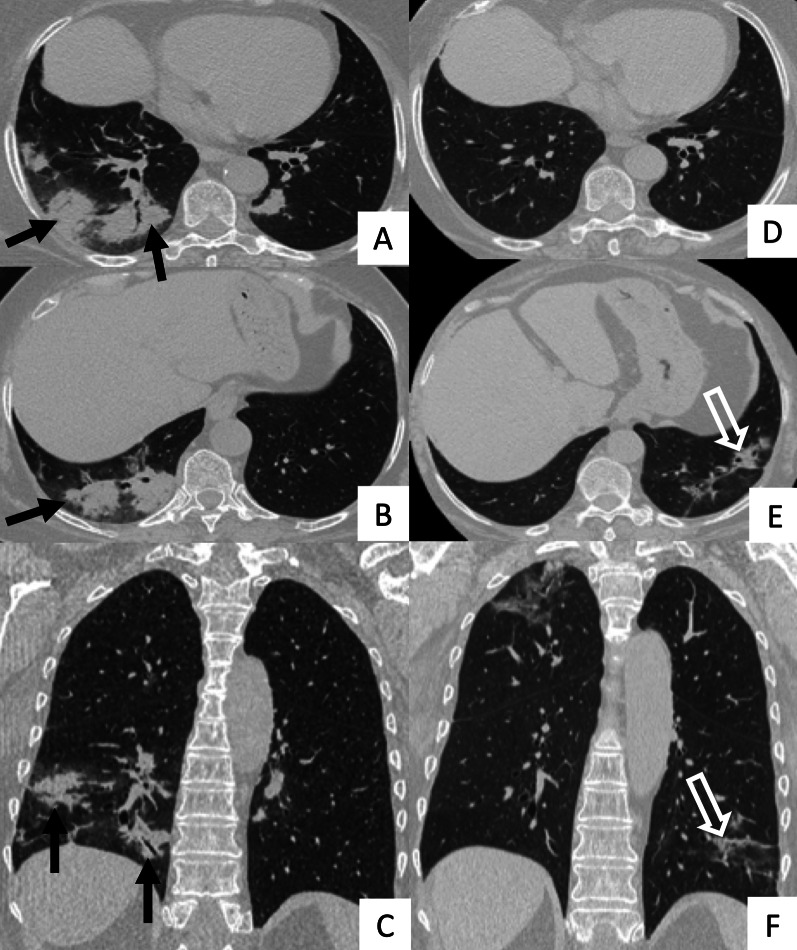 Fig. 17