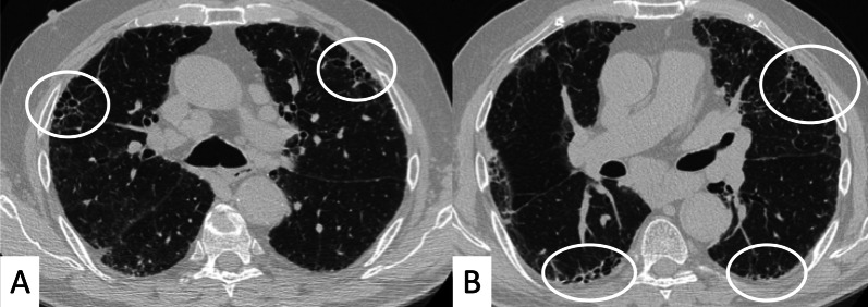 Fig. 12