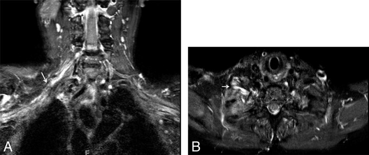 Fig 10.