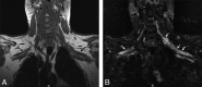 Fig 9.