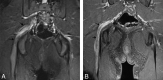 Fig 14.