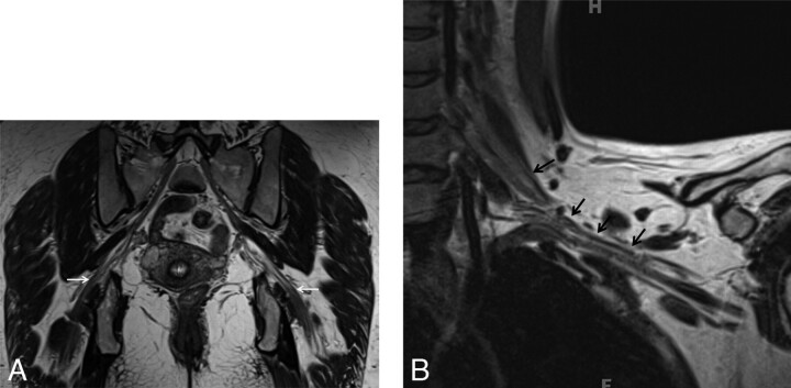 Fig 2.