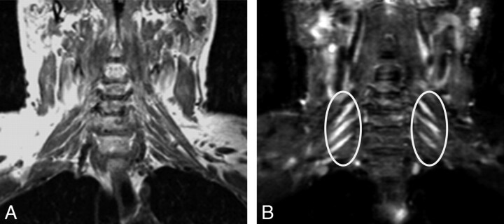 Fig 6.