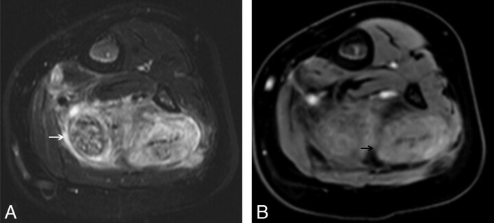 Fig 15.