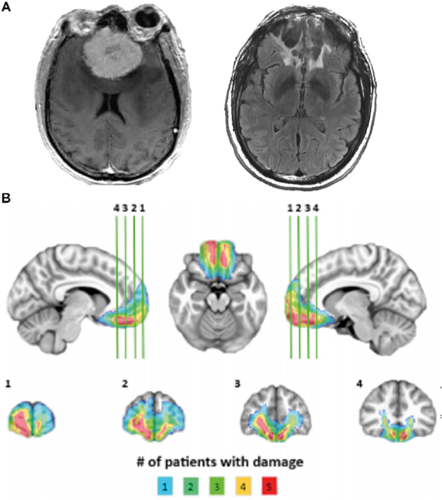 Fig. 1 –