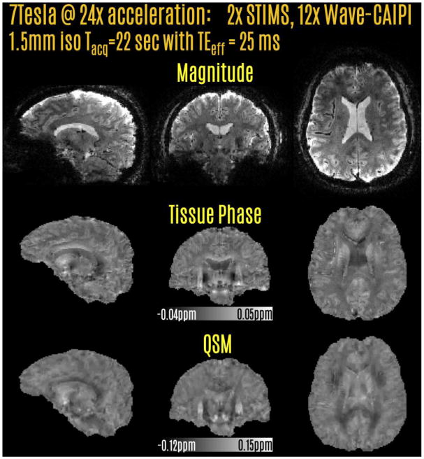 Fig3