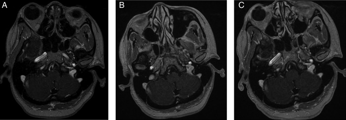 Figure3