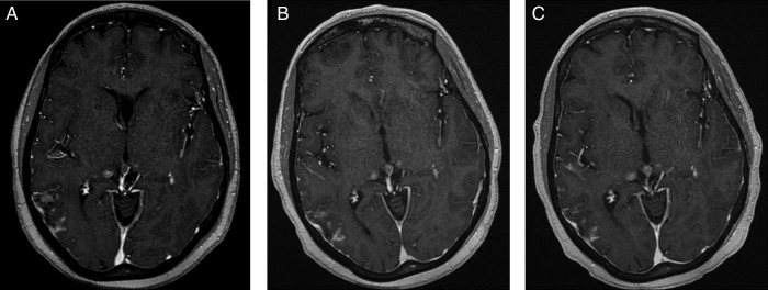 Figure 2