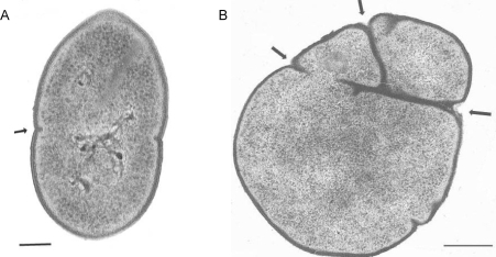 Fig. (4).Electron microscopy of thin sections of R6 parental and pmp23::kan mutant strains.