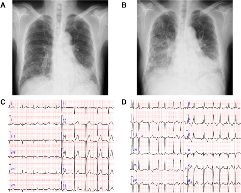 Figure 4